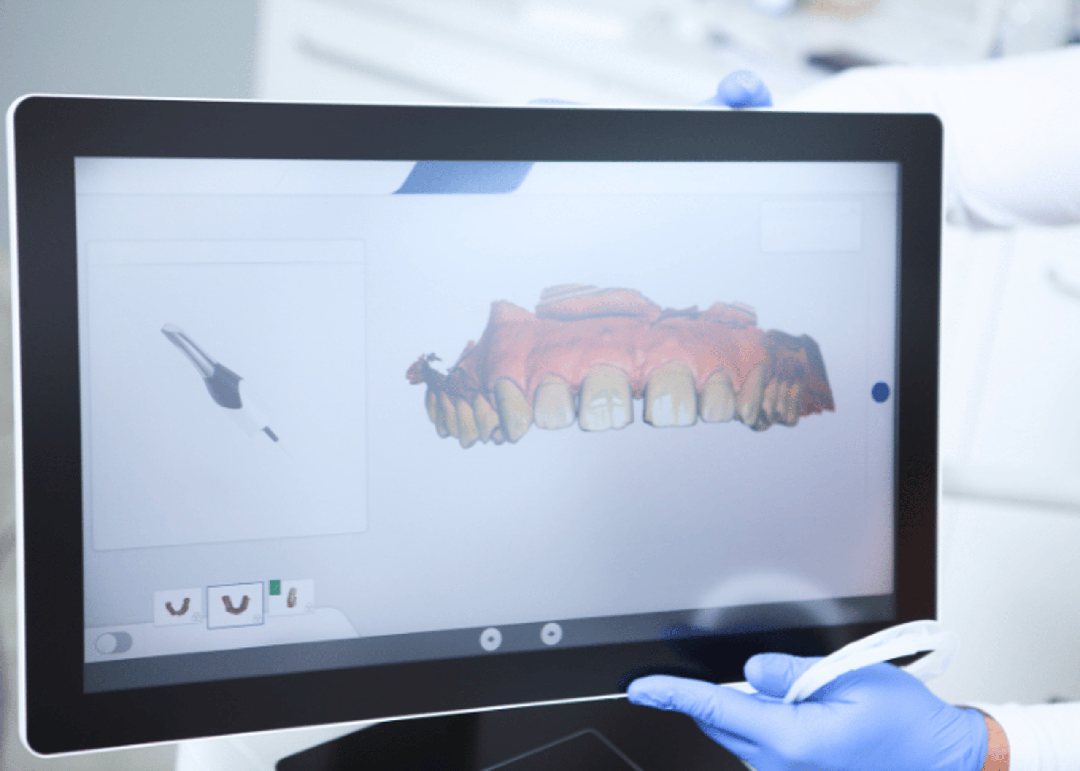 3D-Modell der Zähne auf dem Praxisbildschirm
